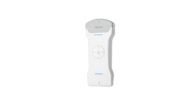 Telemedicine Ultrasound Probe