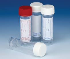 MR Urine Sample Pots
