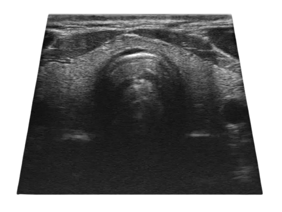 Sonoscape E1 Ultrasound machine (4)