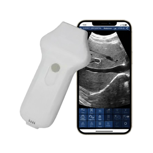SunSmart Phased Array Wireless Ultrasound Probe