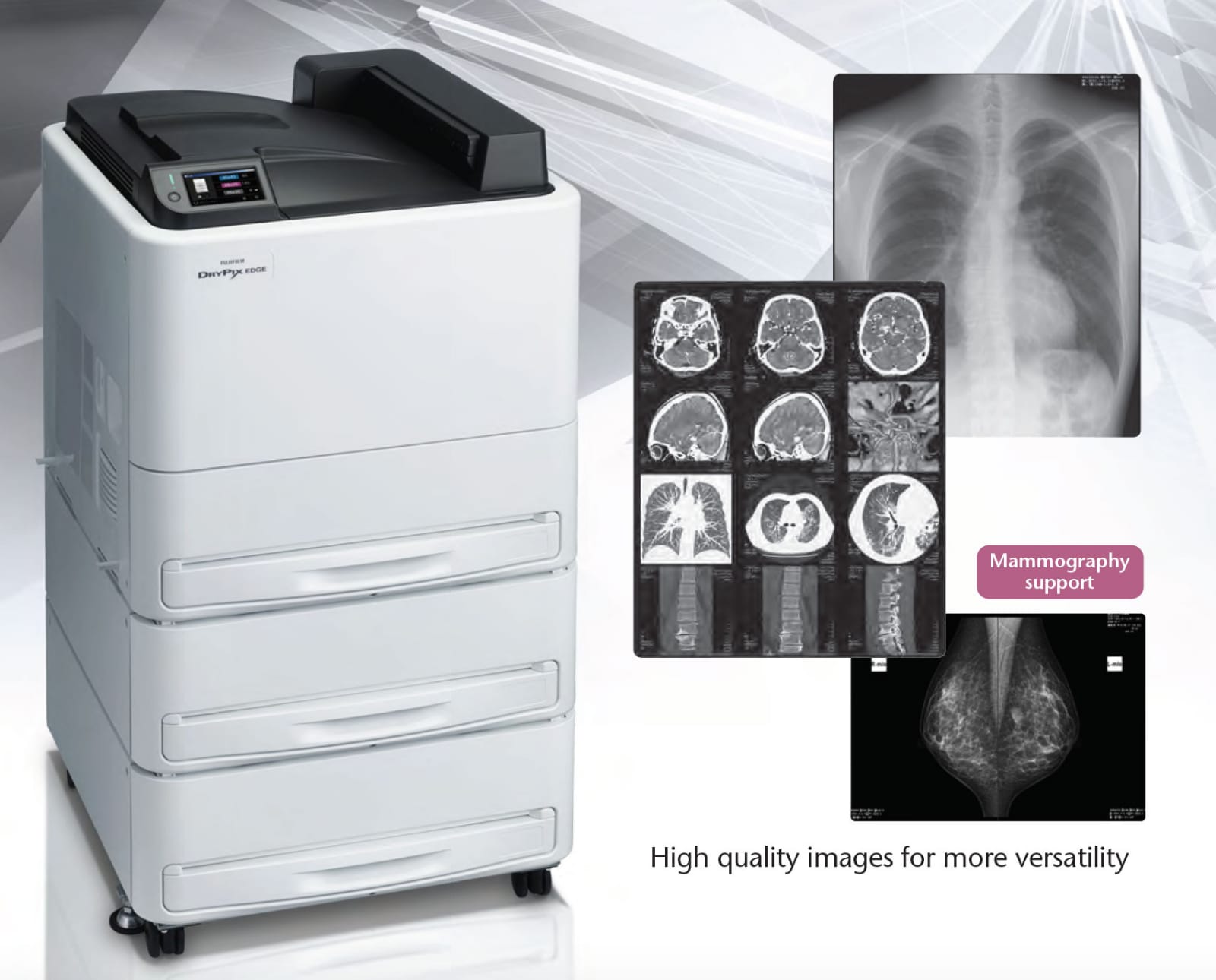 Fujifilm DryPix EDGE – High-Speed Diagnostic Printing