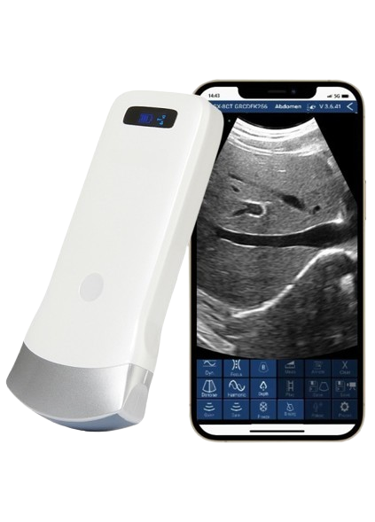 SonoSmart Linear-16C Wireless Ultrasound Probe