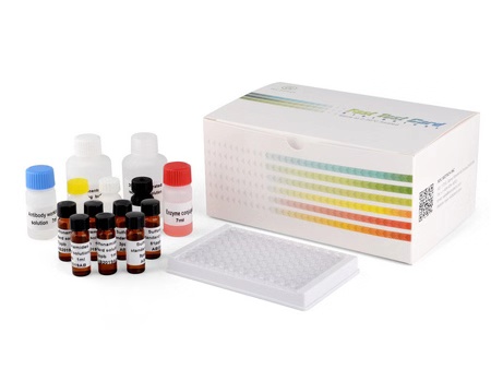 Immunoglobulin E IGE Elisa Test Kit - 96 Test