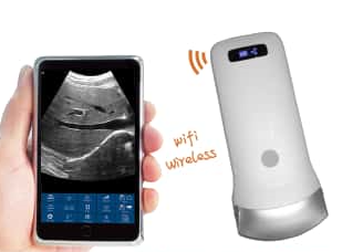 Wireless Probe Ultrasound Scanne