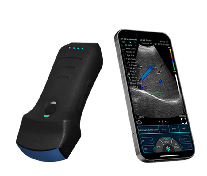 Dual-Probes Multipurpose Wireless Ultrasound - Convex + linear + Cardiac Probe