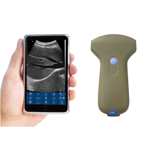 Sonosmart Mini Probe type palm Ultrasound Scanner