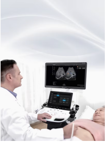SonoScape P12 Elite Ultrasound Machine