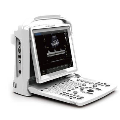 Chison ECO-3 Expert Portable Color Ultrasound