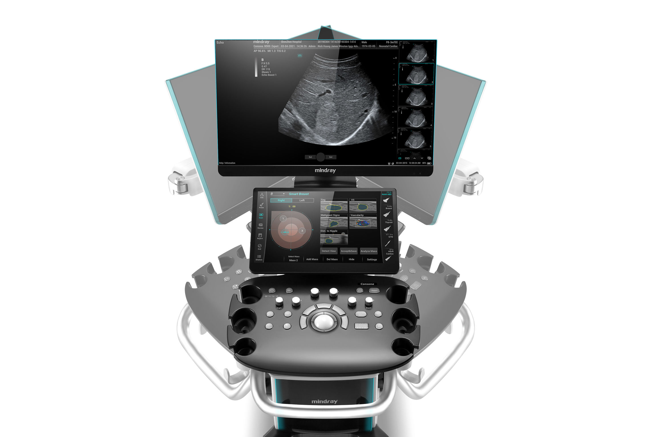 Mindray Consona N6 Ultrasound Machine - Best Price in Bangladesh