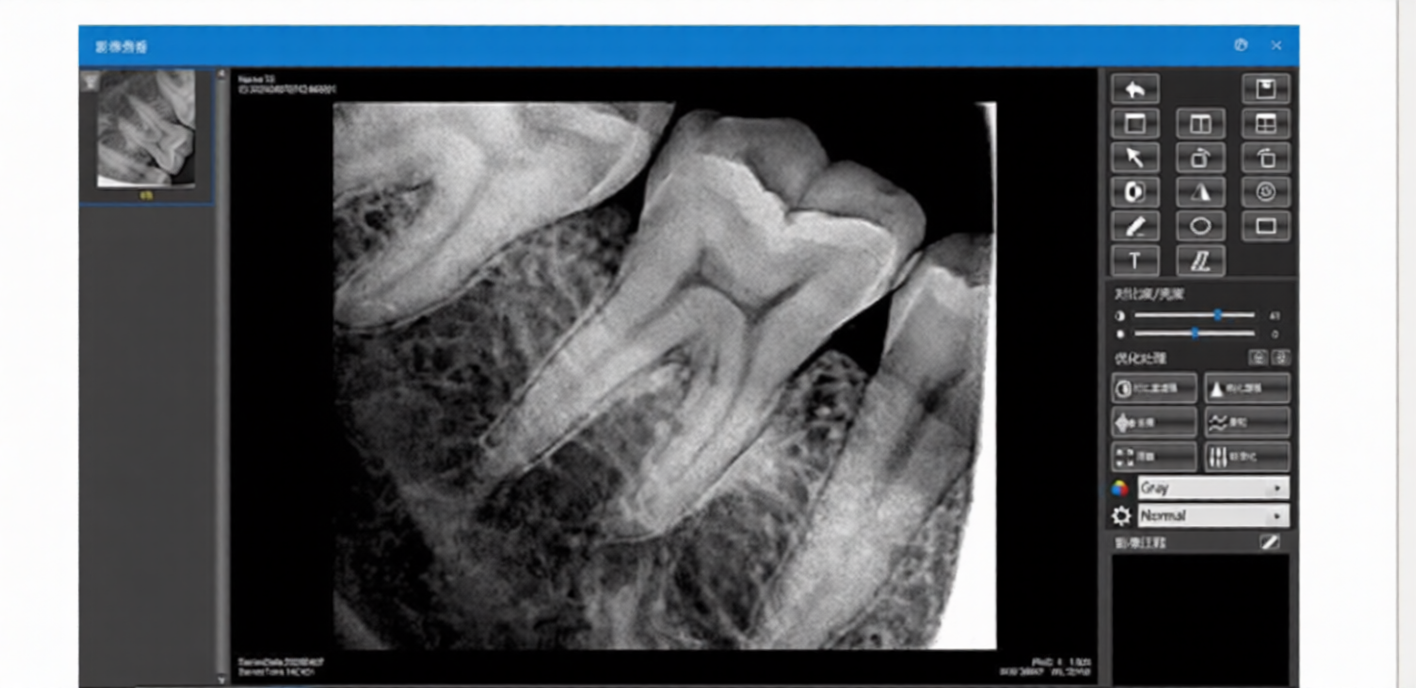 Professional Dental Digital X-Ray Sensor Ai-Enhanced