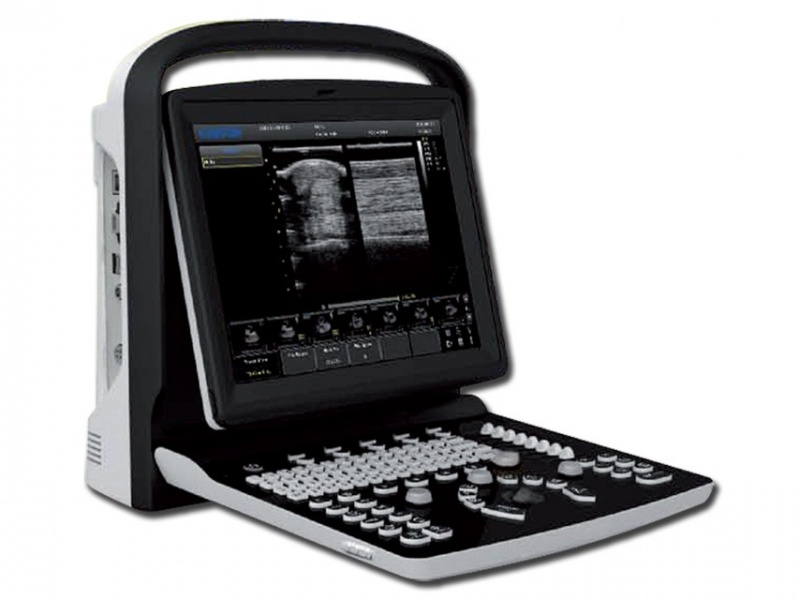 Chison ECO-1 Portable Ultrasound