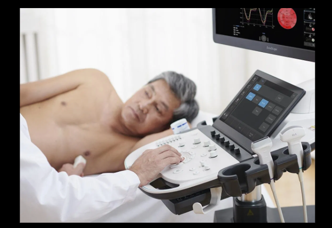 SonoScape P12 Elite Ultrasound Machine