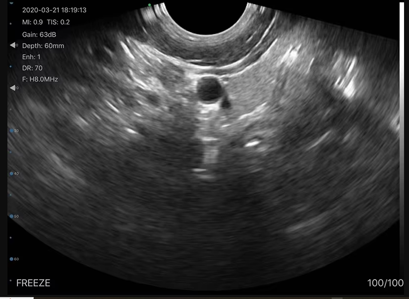 SunSmart Phased Array Wireless Ultrasound Probe