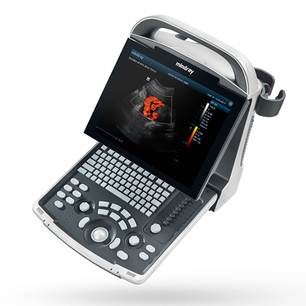 Mindray DP 30 Portable Ultrasound Machine