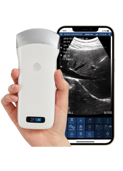 SonoSmart 16C Convex Wireless ultrasound Probe