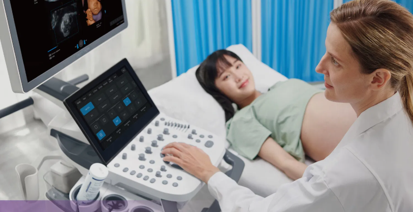 SonoScape P25 Elite Ultrasound Machine