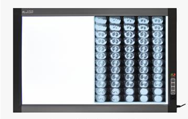 Flmplent Double ZG-2D LED X-Ray Film Viewbox