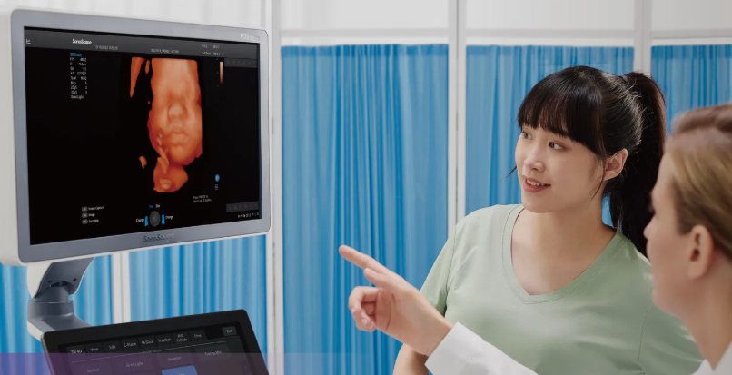 SonoScape P25 Elite Ultrasound Machine