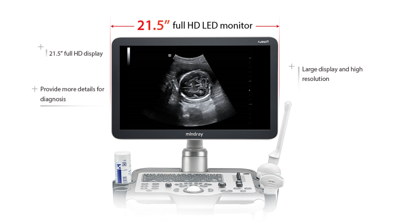 Mindray DC 32 Full HD Diagnostic Ultrasound System - 17 inch Monitor