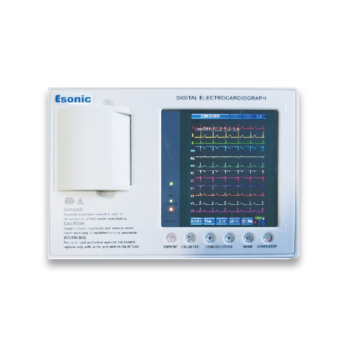 Esonic-303C 3 Channel -ECG Machine