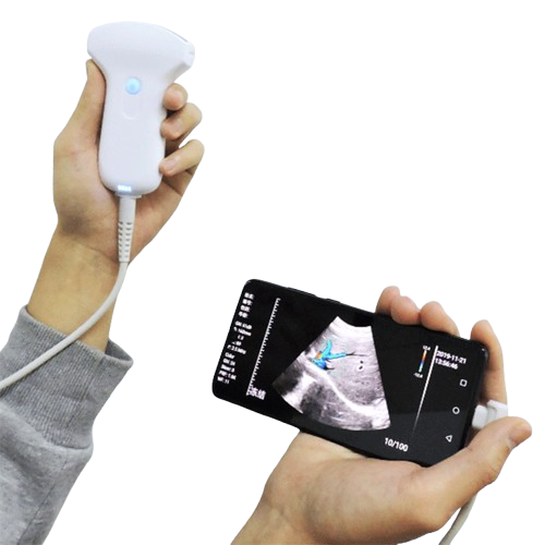 SonoSmart 16D Linear Wireless ultrasound Probe
