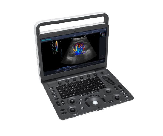Sonoscape E2 Color Doppler Ultrasound machine