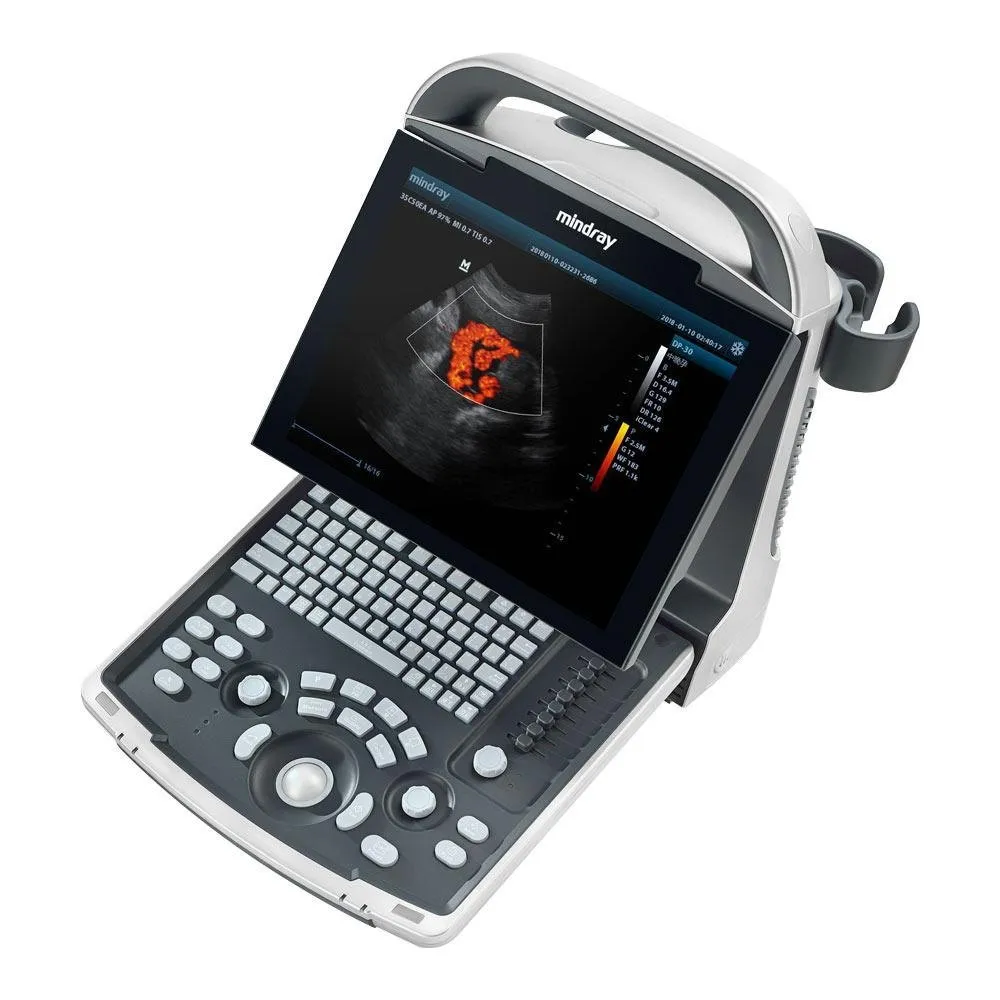Mindray-DP-21-Power-2.webp