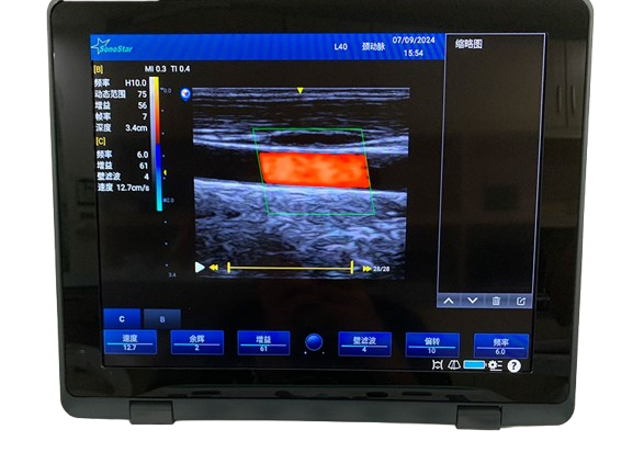 Ultrasound Machine Sonostar C5N