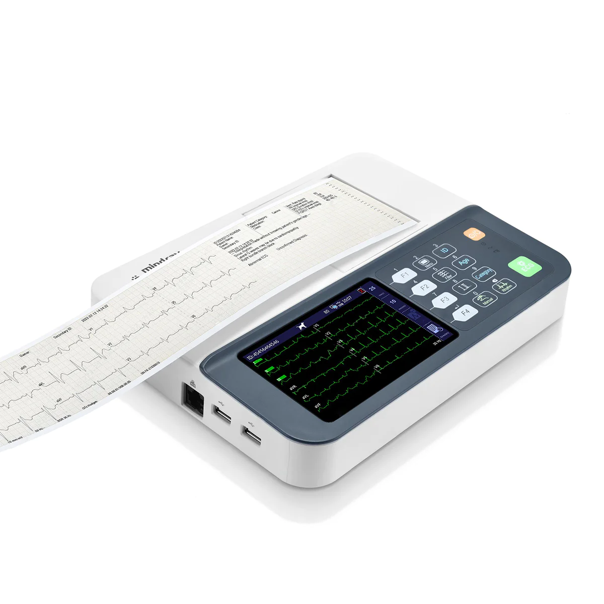 BeneHeart R3 ECG Machine - Mindray