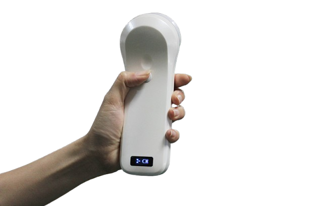 SonoSmart 4D Bladder Wireless Ultrasound Probe