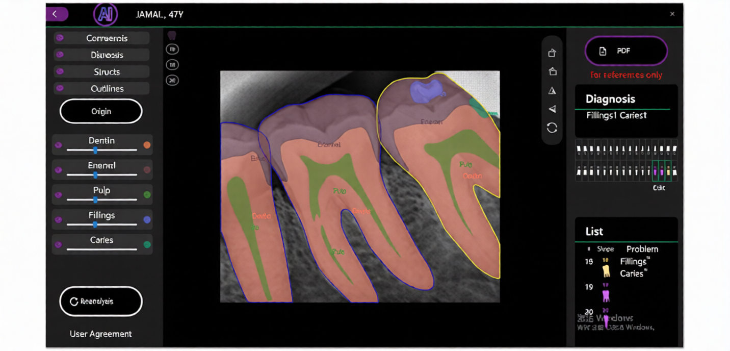 Professional Dental Digital X-Ray Sensor Ai-Enhanced (2)