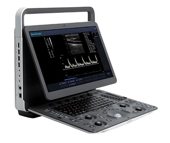 Sonoscape E1 Ultrasound machine