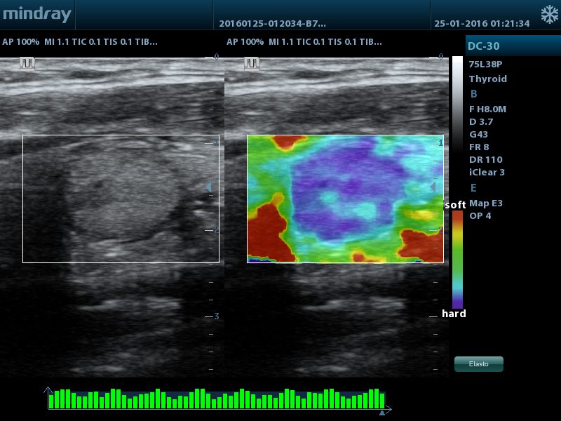 Mindray DC-30 Ultrasound System 4D Color Doppler