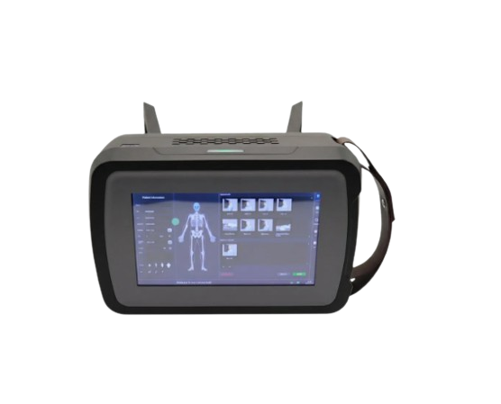Forever YJ-BW905 Handheld X ray Machine Price in Bangladesh