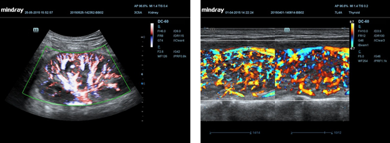 4D Color Doppler Ultrasound System Mindray DC-60