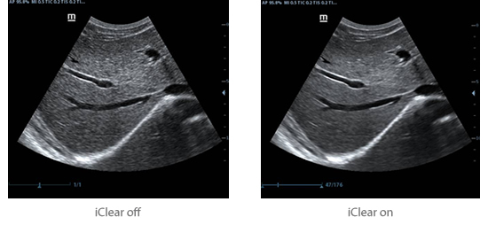 Mindray DC-30 Ultrasound System 4D Color Doppler
