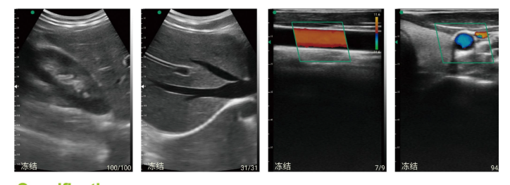 Wireless Probe Ultrasound Scanne