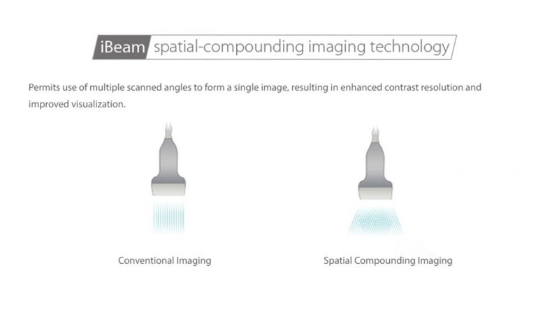 Product feature illustration