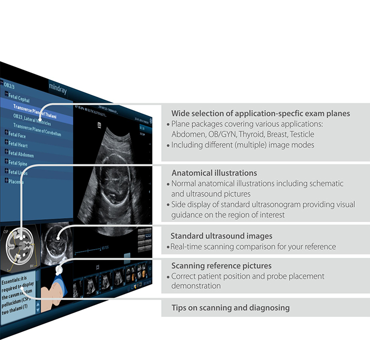 Mindray DC-30 Ultrasound System 4D Color Doppler
