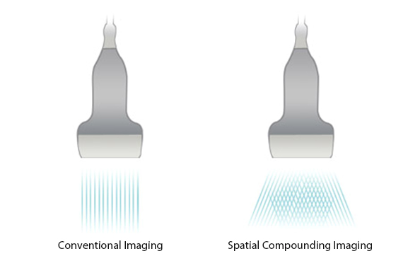 Product feature illustration