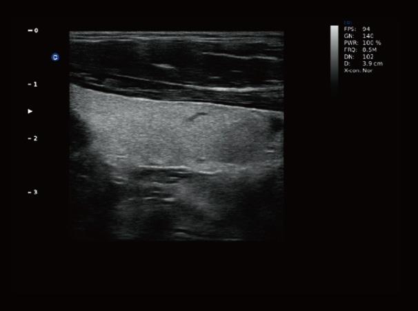 Chison QBit-3 Ultrasound Machine