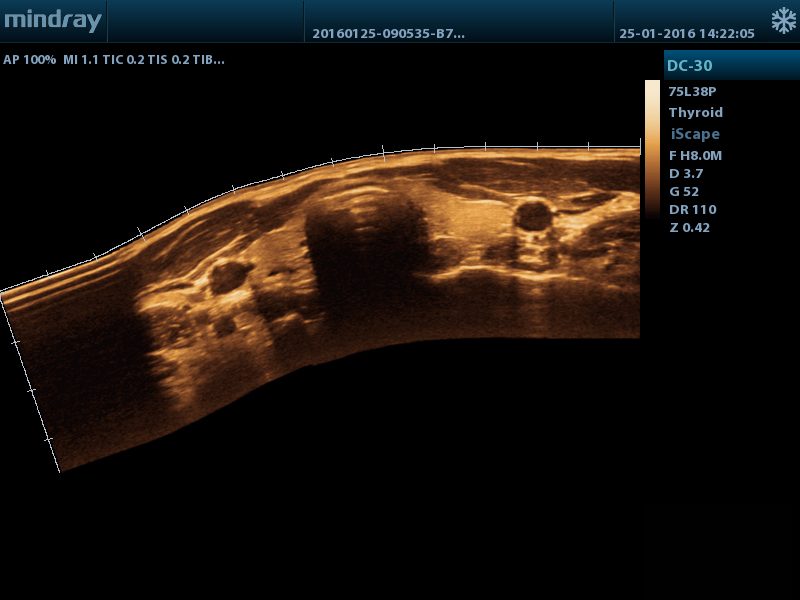 Mindray DC-30 Ultrasound System 4D Color Doppler