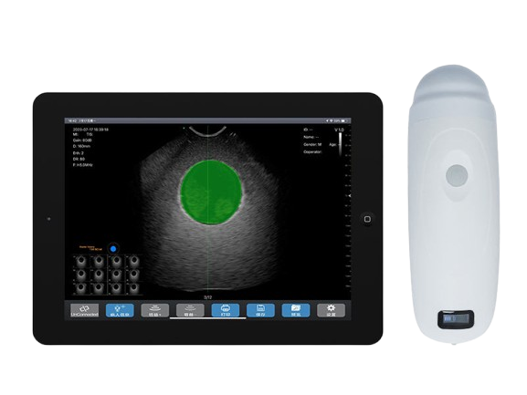 Wireless Ultrasound Probe