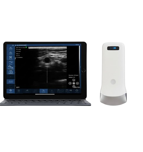 SonoSmart 16C Linear Wireless ultrasound Probe
