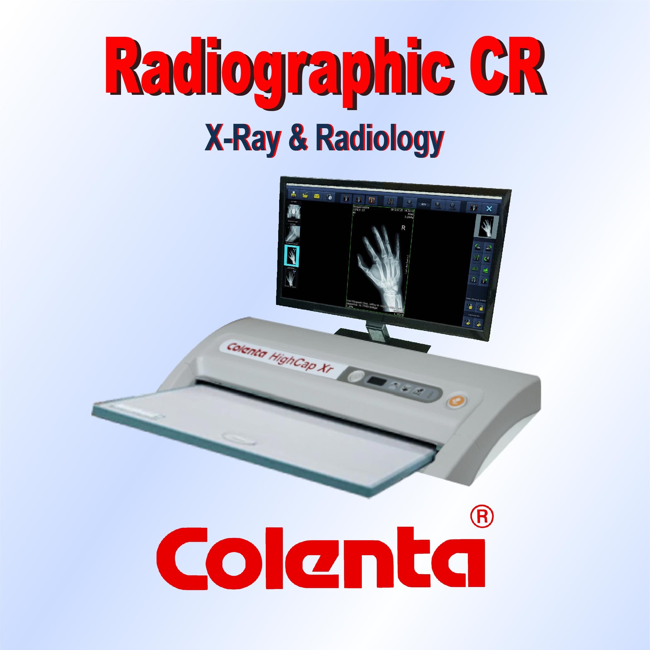 Colenta CR (Computed Radiography) System