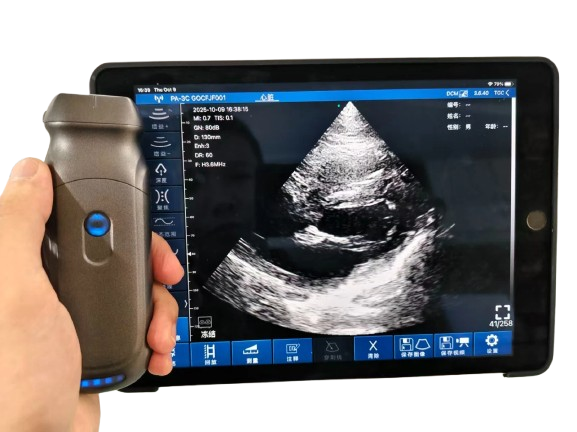 Wireless Probe Type Ultrasound Scanner