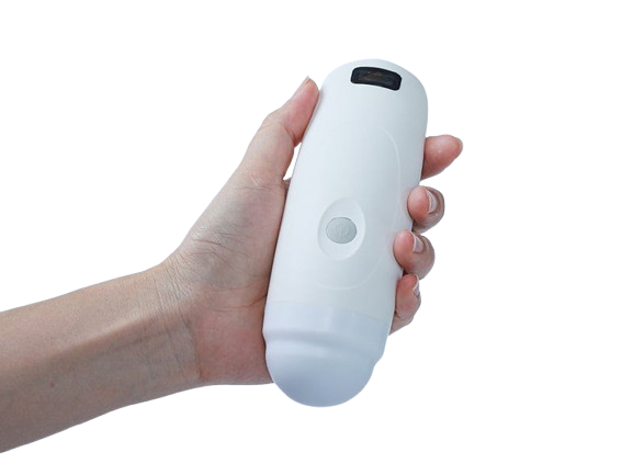 SonoSmart 4D Bladder Wireless Ultrasound Probe