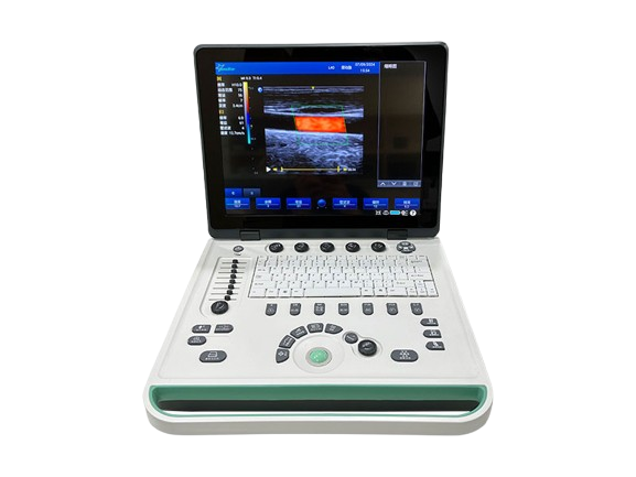 Sonostar C5N Ultrasound Machine Laptop Color Doppler