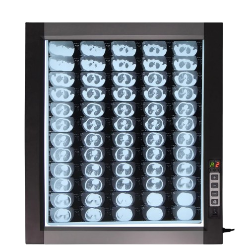 Flmplent Single ZG-1D LED X-Ray Film Viewbox