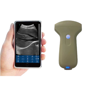 Sonosmart Mini Probe type palm Ultrasound Scanner